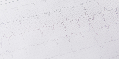 Kardiologie Böhmerwaldplatz - Herzrythmusstörungen / Vorhofflimmern
