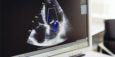 Kardiologie Böhmerwaldplatz - Herzschwäche